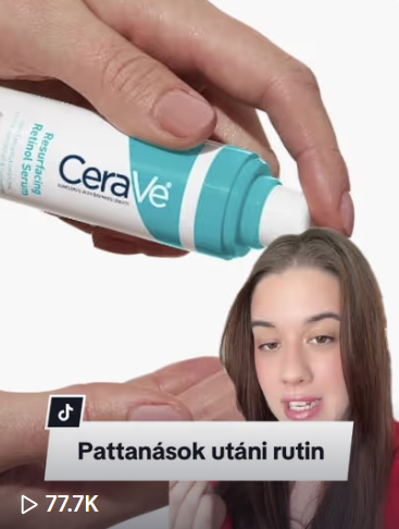 '@skinsbyvivi ad pár tippet pattanásos bőr ápolására.